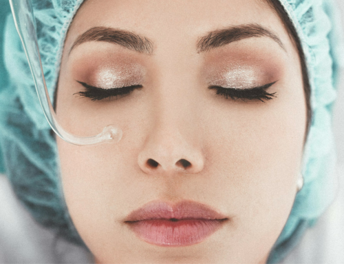 Come Prevenire i Lividi Prima di Botox, Newtox o Filler